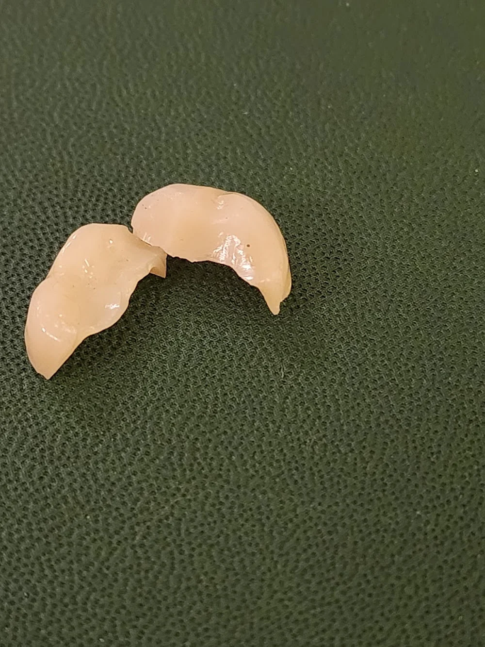 Galaxy Dental of Wheeling Picture 10