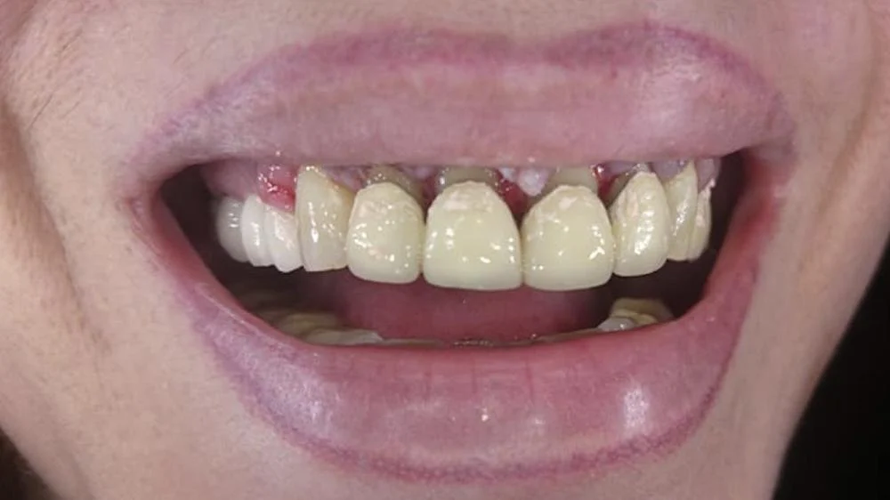 Oceansight Dental & Implants | Ali John Jazayeri, DDS Picture 4