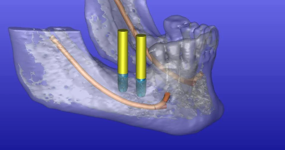 Seven Hills Dental & Implant Center Picture 3