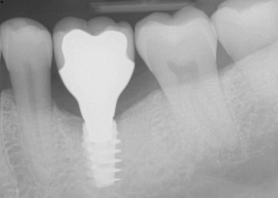 Seven Hills Dental & Implant Center Picture 4