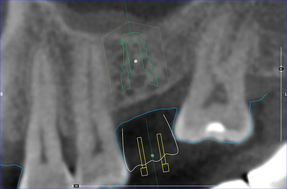 Dentist Riverside - TranscenDental Smiles Picture 8