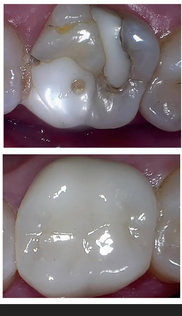 Dentist Riverside - TranscenDental Smiles Picture 9