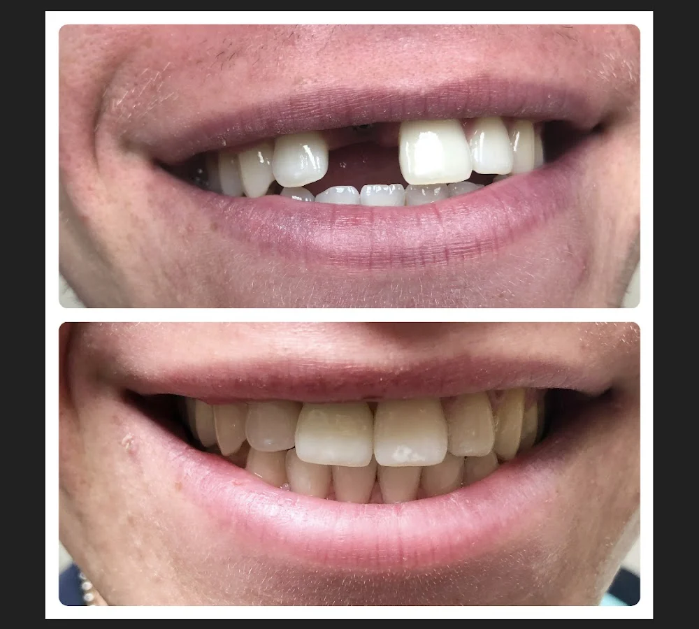 Dentist Riverside - TranscenDental Smiles Picture 7