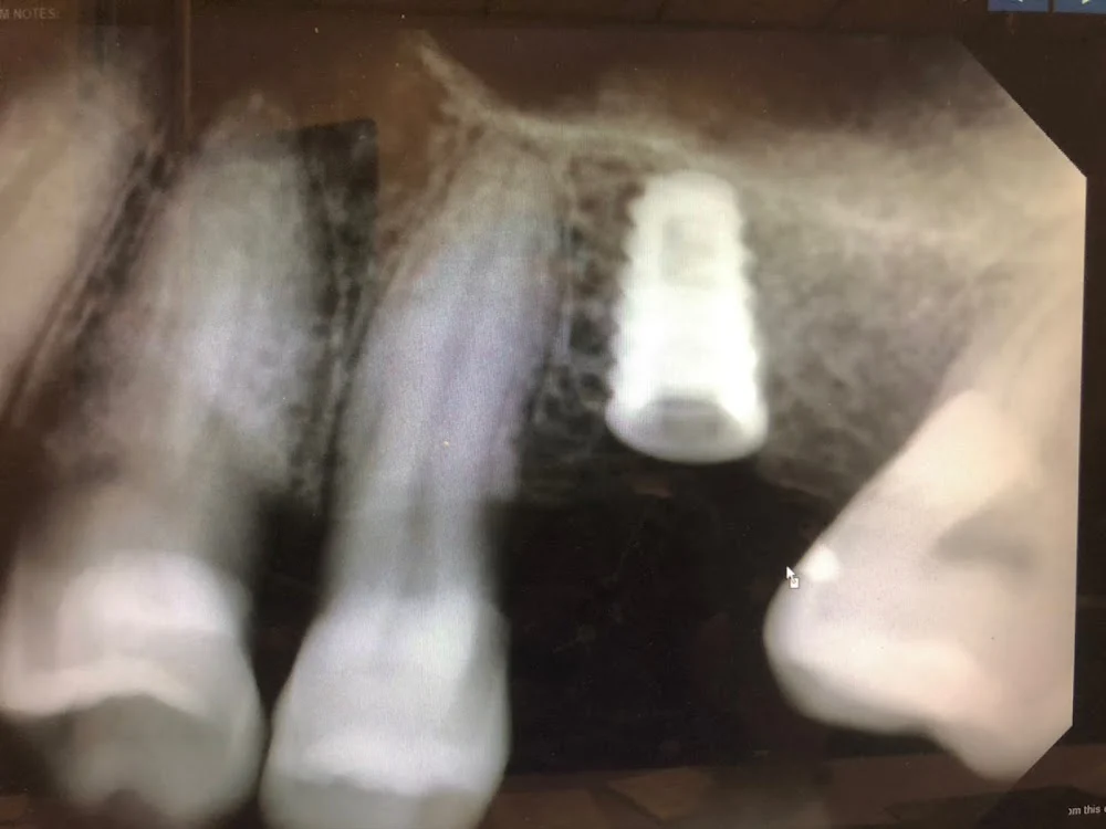 Dentist Riverside - TranscenDental Smiles Picture 10