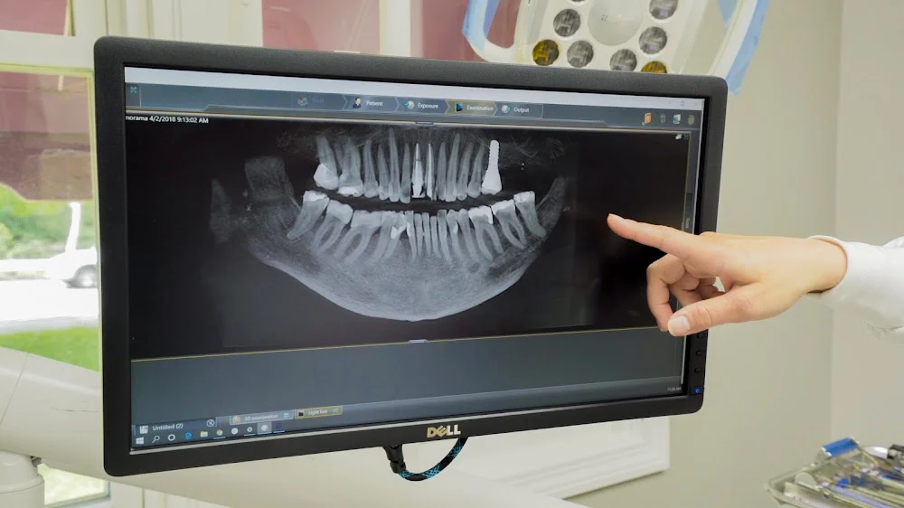 Beyond Dental Health - Hanson Picture 5