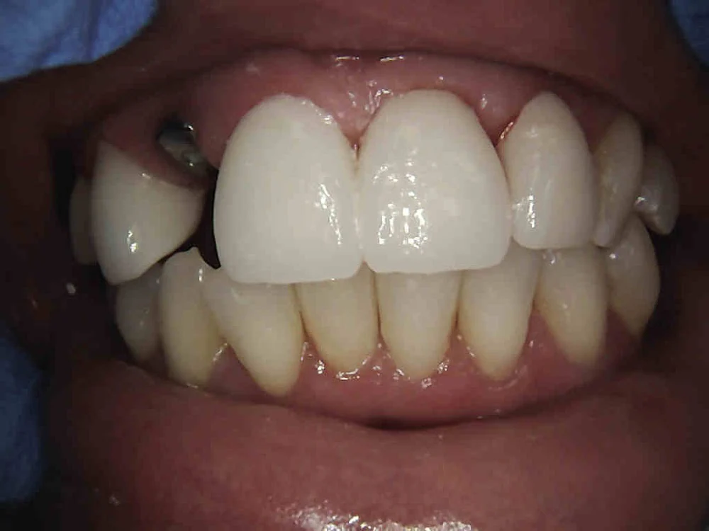 Smile Dental of New Rochelle Picture 1