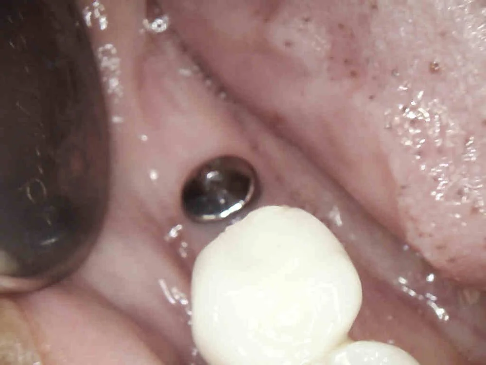 Smile Dental of New Rochelle Picture 4