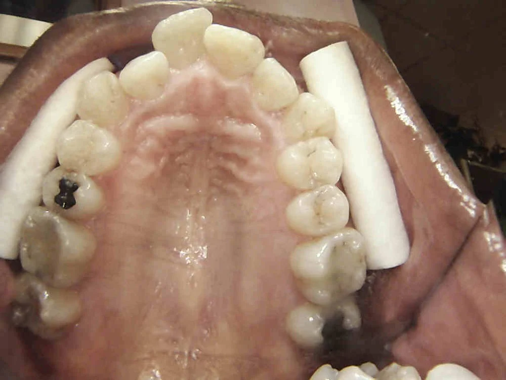 Smile Dental of New Rochelle Picture 2