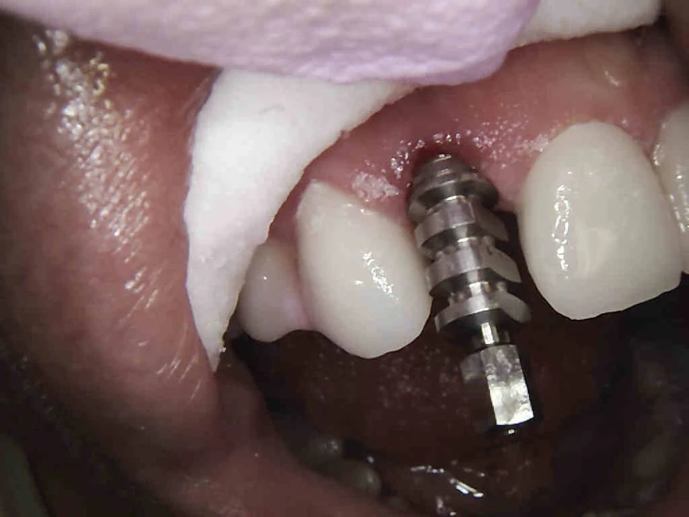 Smile Dental of New Rochelle Picture 3