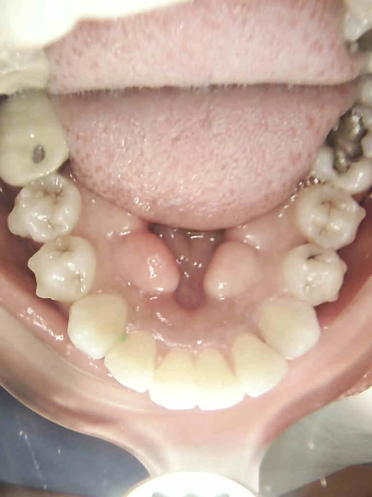 Smile Dental of New Rochelle Picture 10
