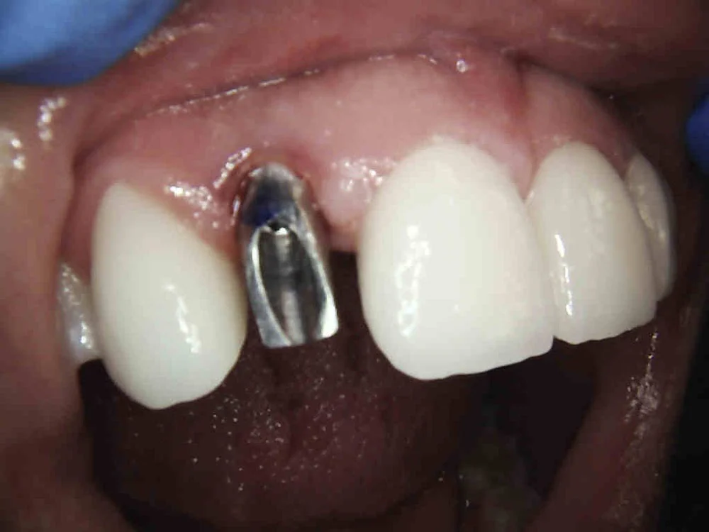 Smile Dental of New Rochelle Picture 7