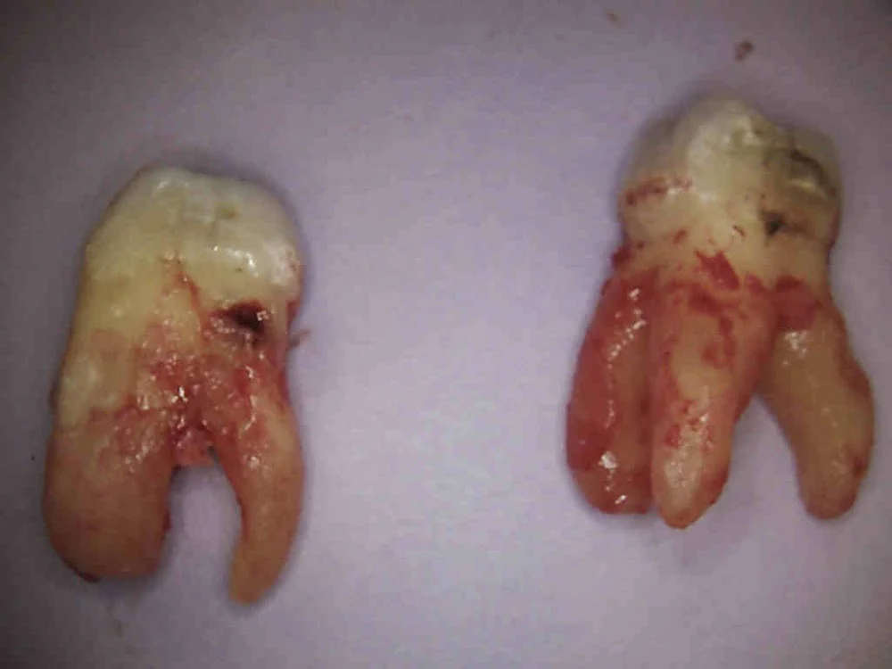 Smile Dental of New Rochelle Picture 9