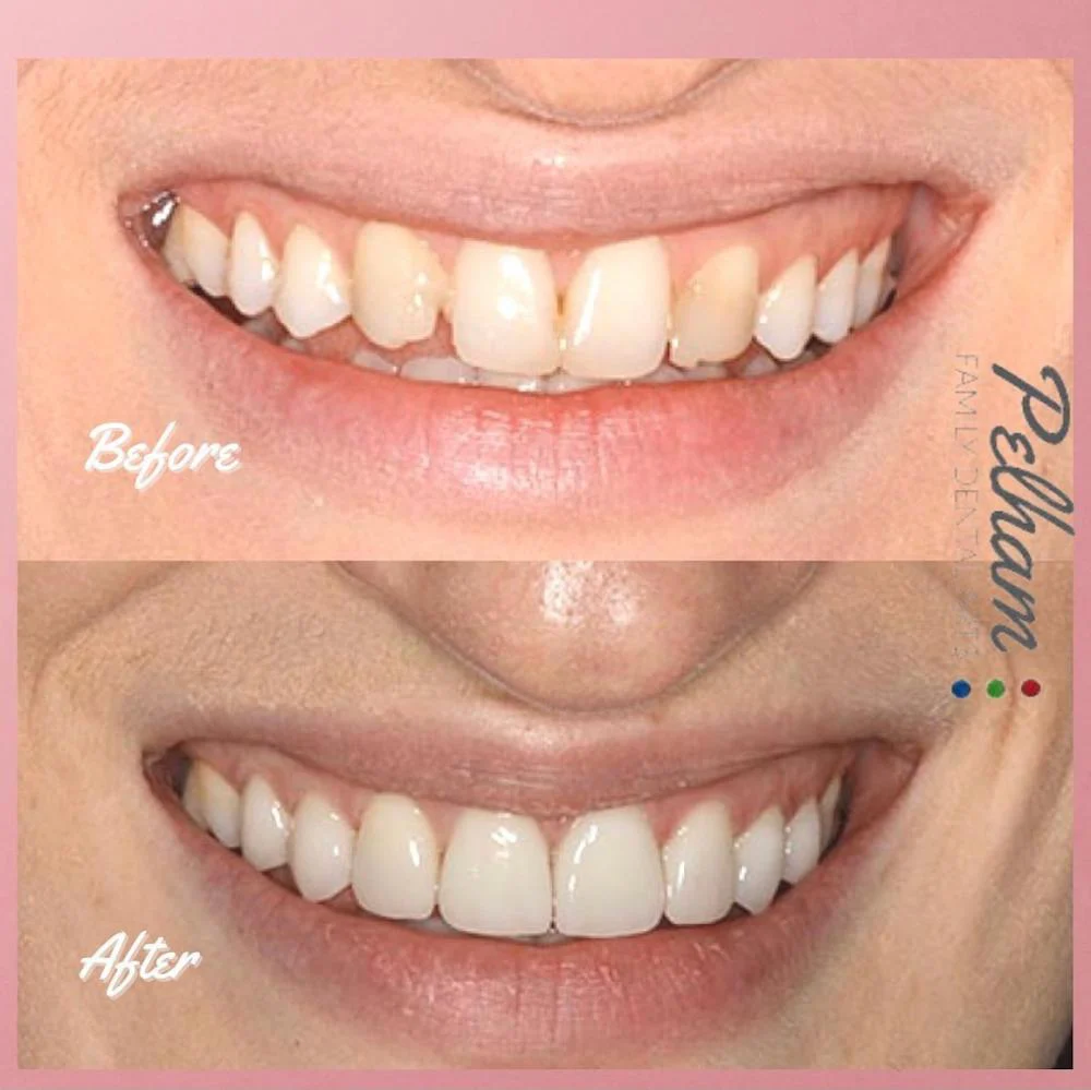 Pelham Family Dental Arts PC: Shay Markovitch, DDS Picture 6