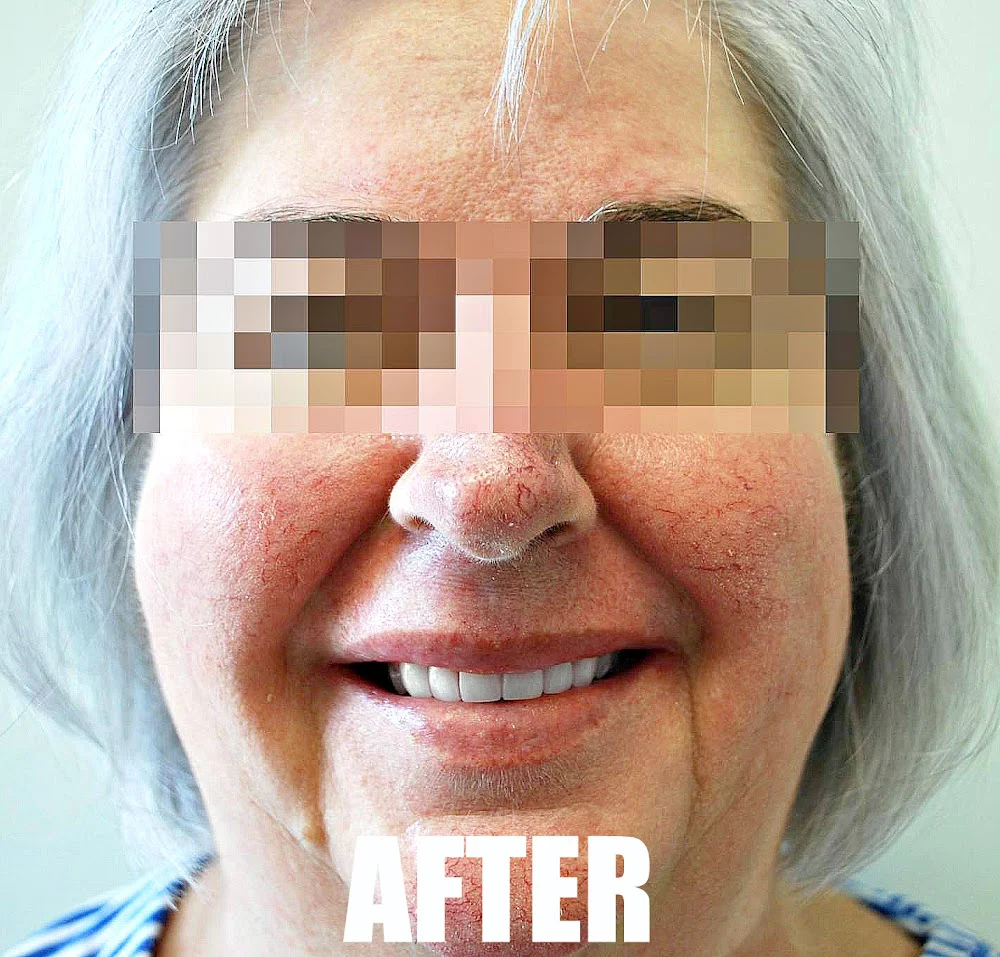 Mint Dental Tacoma Picture 7