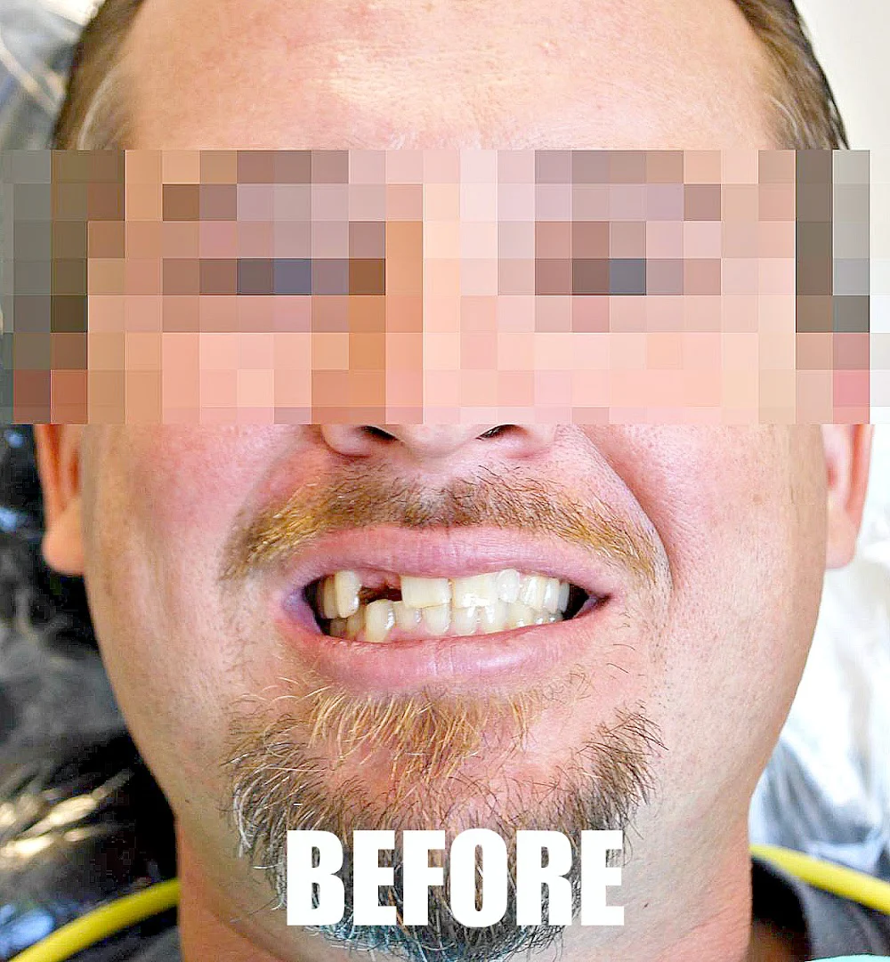 Mint Dental Tacoma Picture 3
