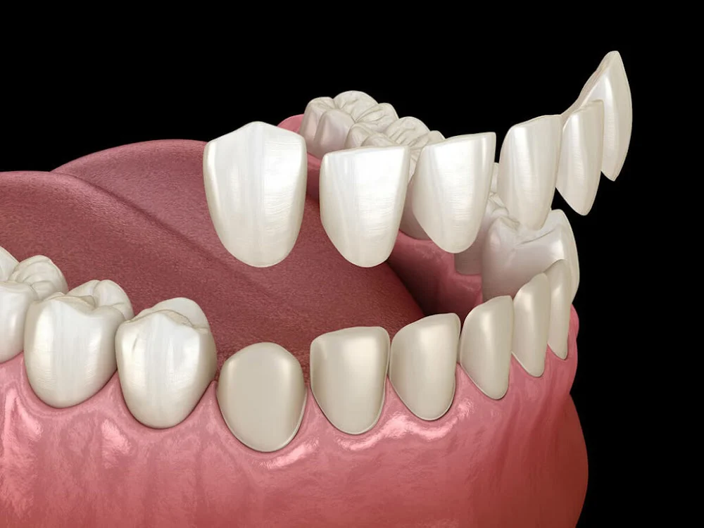Tacoma Dental Care, Dr. Thi Truong Nguyen, DMD. Picture 1
