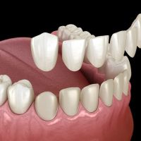 Tacoma Dental Care, Dr. Thi Truong Nguyen, DMD. ico