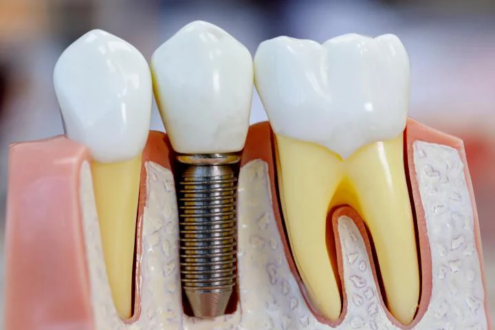 Pacific Smiling Dental & Orthodontics Picture 5