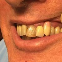 NorthStar Implant Dentistry ico