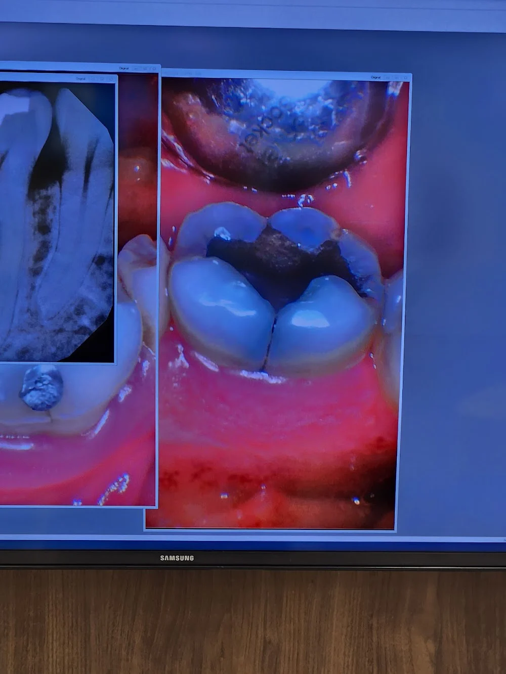 Premier Dental Picture 7