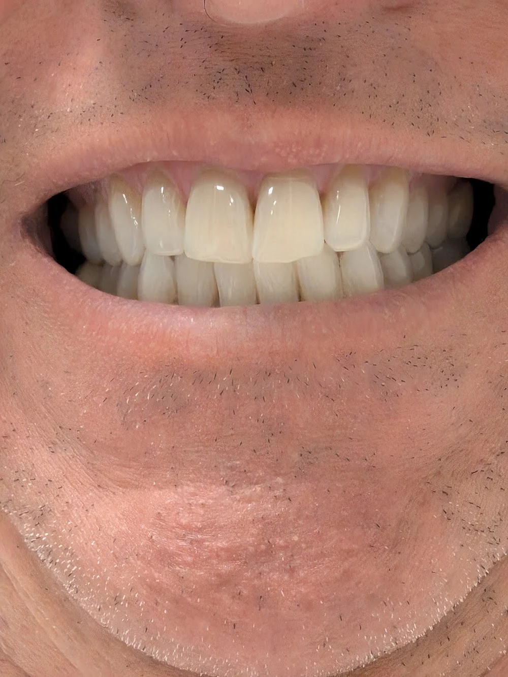 Precision Dentistry Picture 3