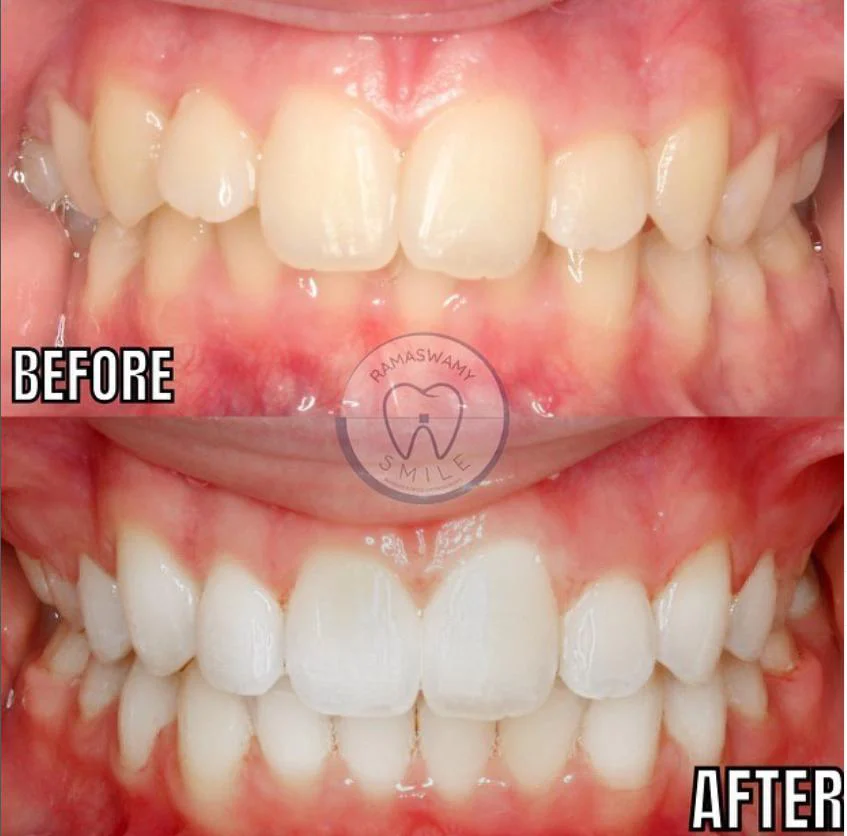 Ramaswamy Orthodontics - Braces, Invisalign Orthodontist Picture 10