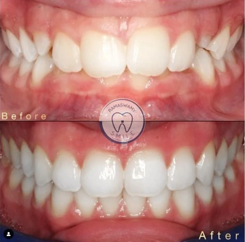 Ramaswamy Orthodontics - Braces, Invisalign Orthodontist Picture 9