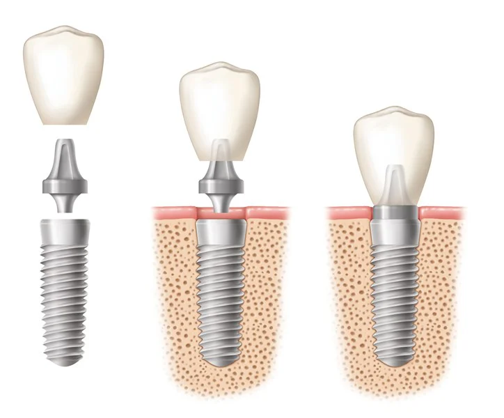 Grand Avenue Family Dental Picture 4