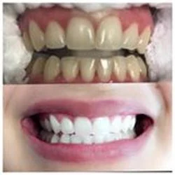All Smiles Family Dental - Dr Sandhya Pallam DDS Picture 10