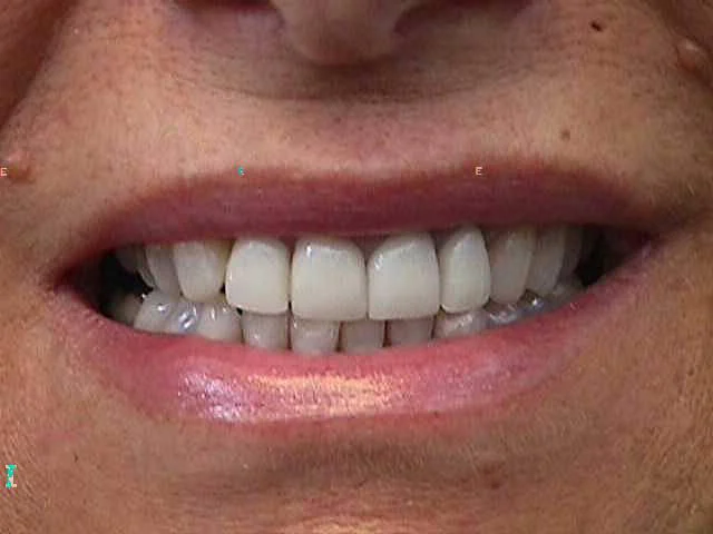 Marshall A. Polan DDS Picture 4
