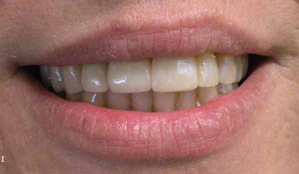 Marshall A. Polan DDS Picture 1