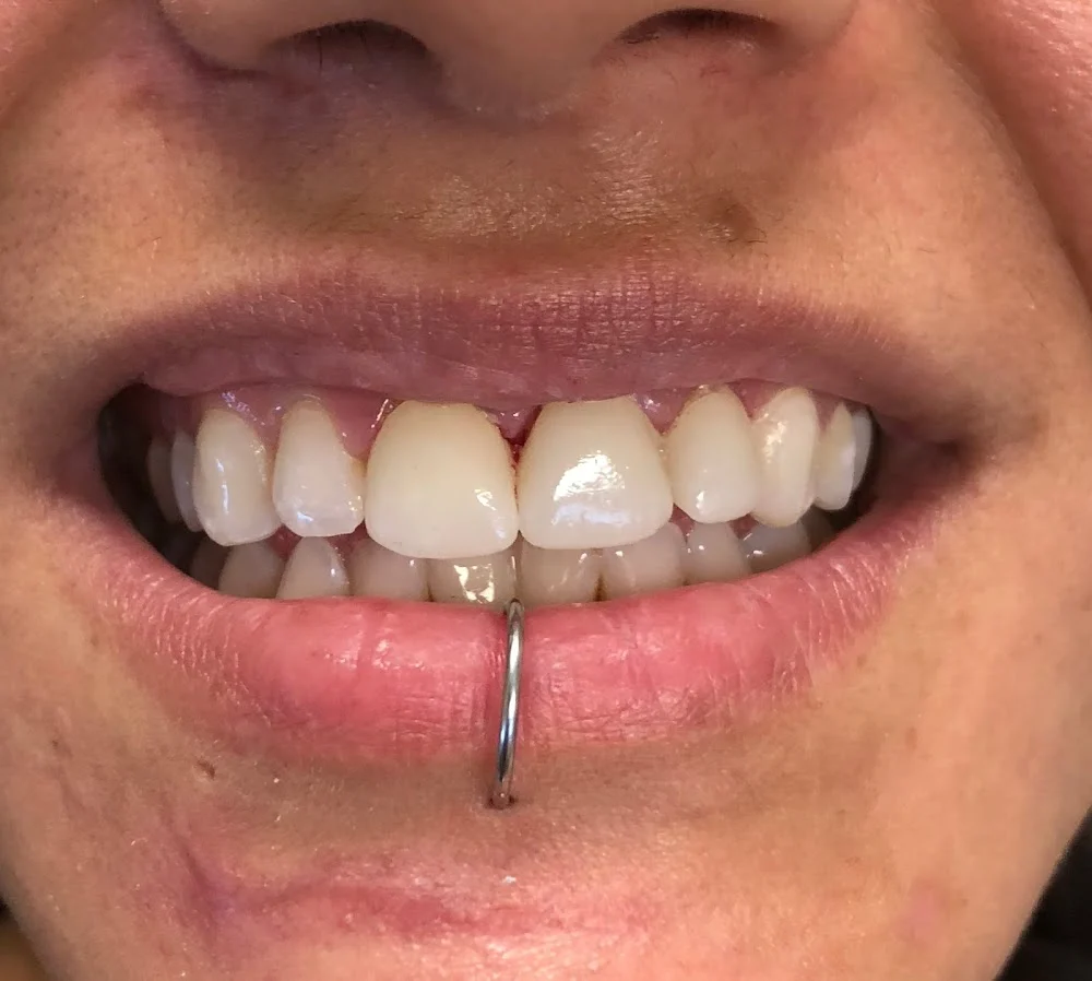 Marshall A. Polan DDS Picture 5