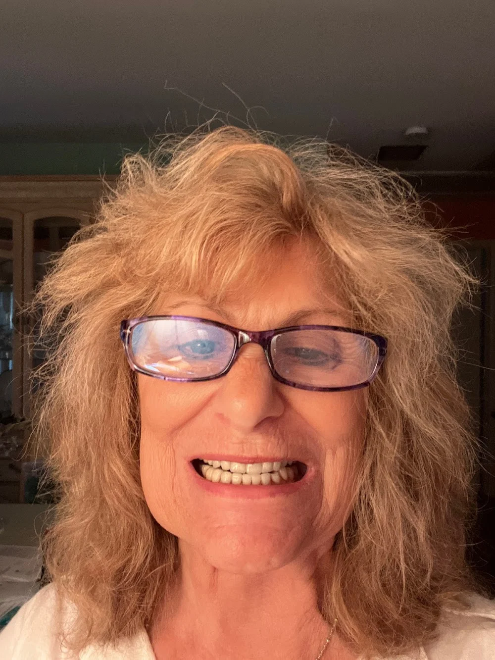 Encore Dental of Toms River - An Affiliate of The Smilist Picture 6