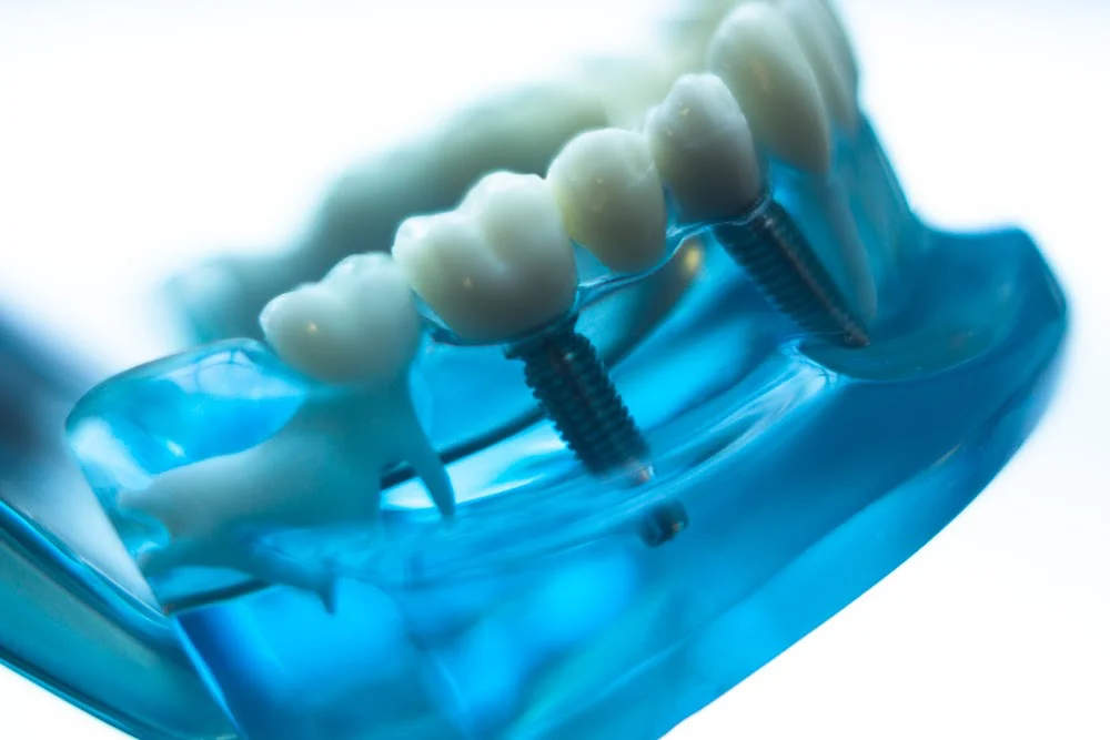 Sun Dental Picture 3