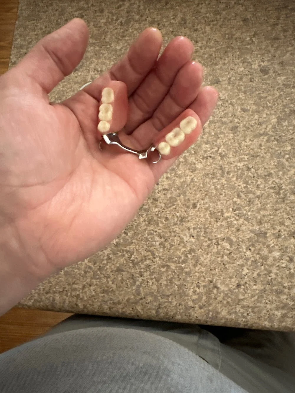 Aspen Dental - Surprise, AZ Picture 10
