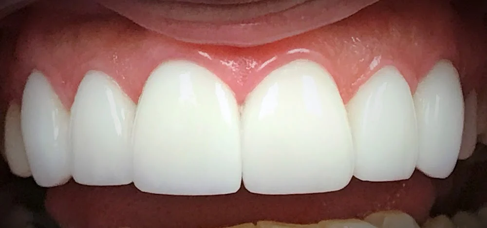 Dr. Fernando Tordoya, DDS,FAGD AFAAID Picture 5