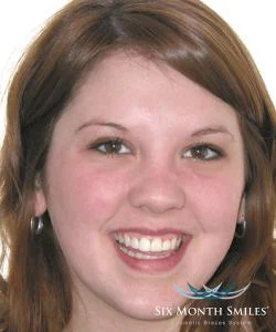Brilliant Smiles Family Dental Picture 4
