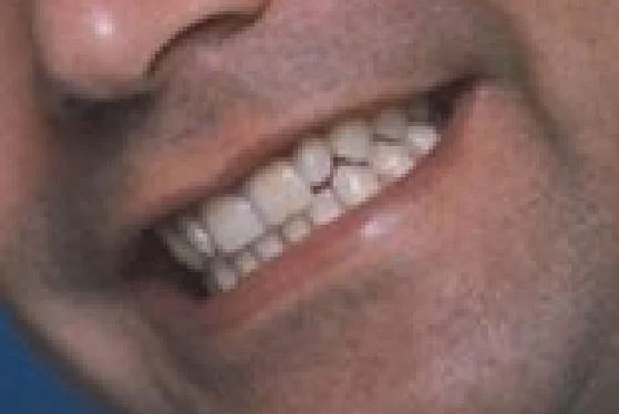 Bob and Peg's Dental Picture 2