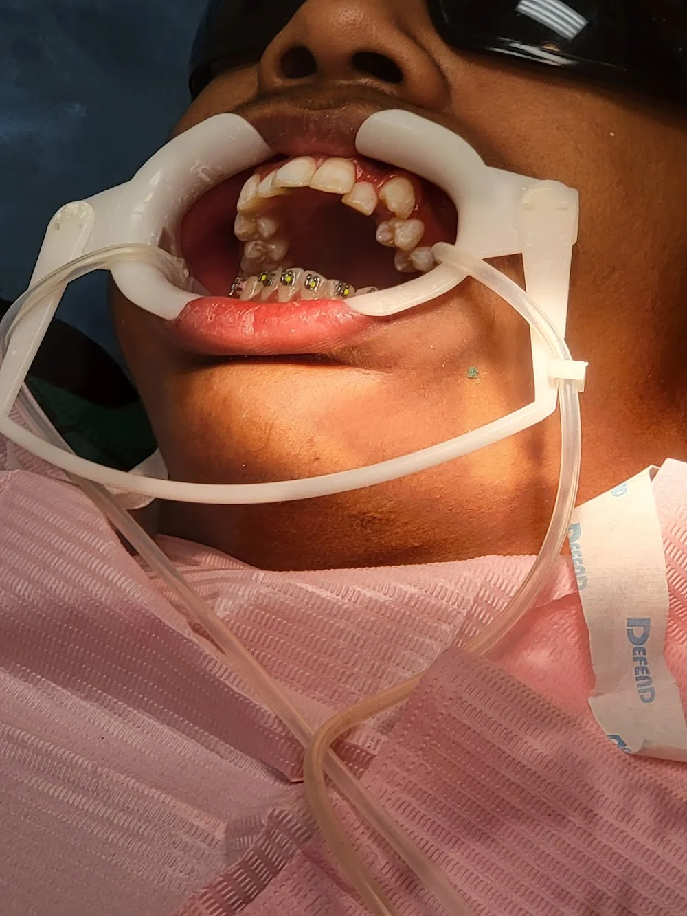 Primary Dental Picture 6
