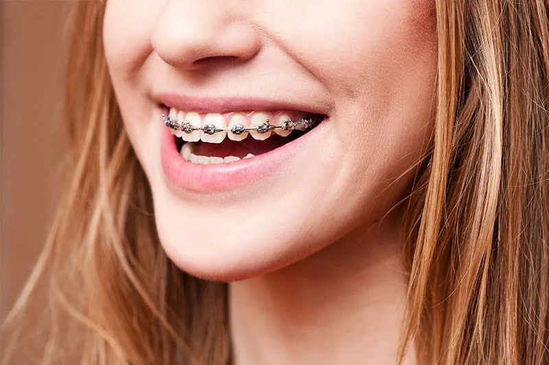 Hanover Dental Picture 9
