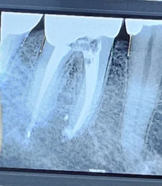 Hanover Dental Picture 3