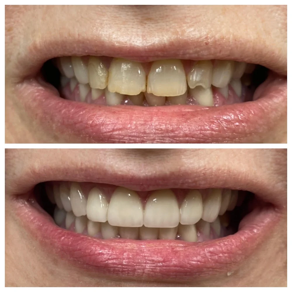 Neshaminy Valley Dentistry Picture 10