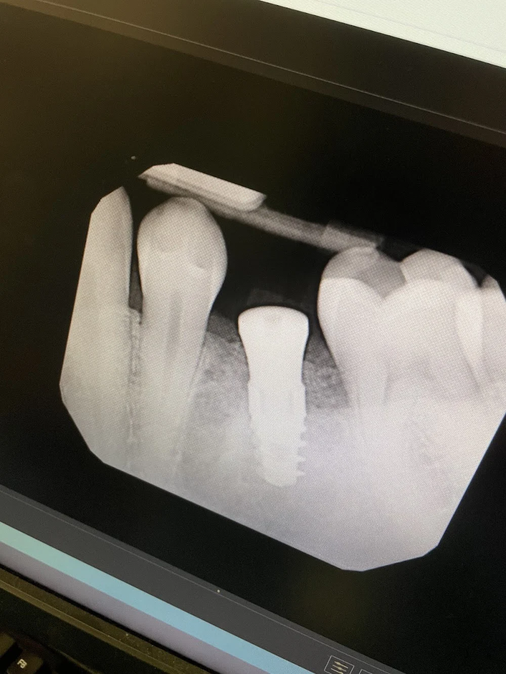 ImplantWIDE Schaumburg Picture 7