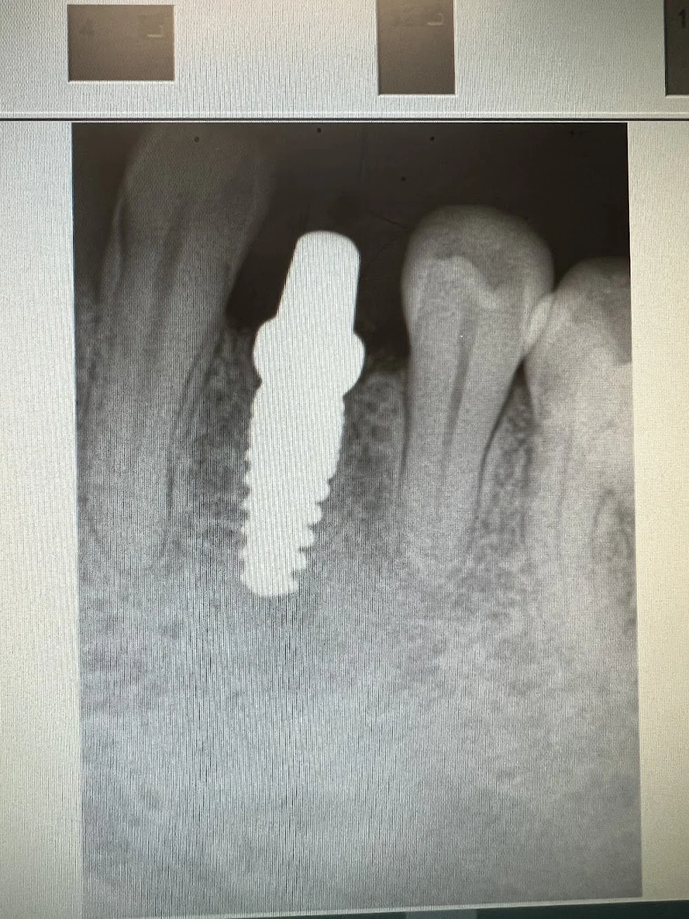 ImplantWIDE Schaumburg Picture 5