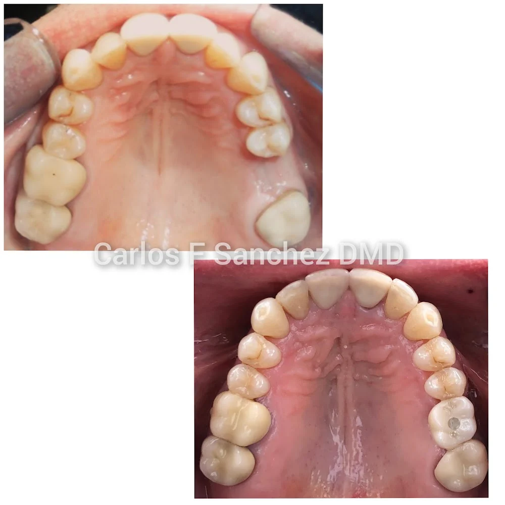 Penndel Dental -- Carlos F. Sanchez DMD Picture 5