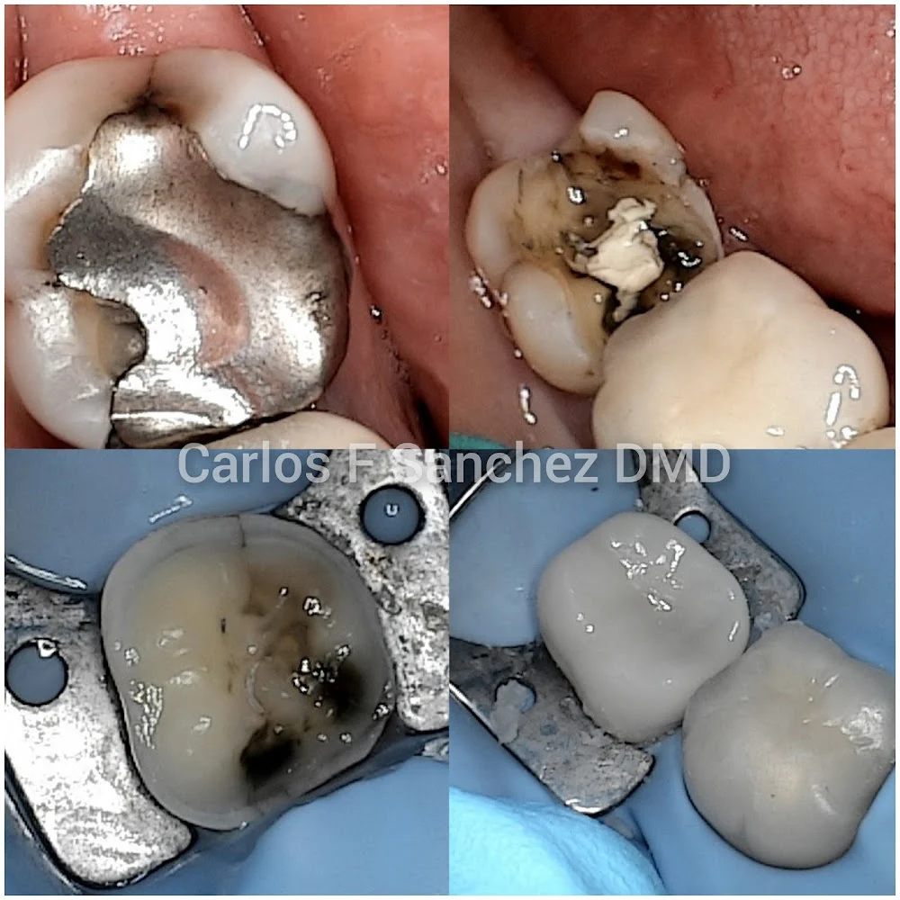 Penndel Dental -- Carlos F. Sanchez DMD Picture 9