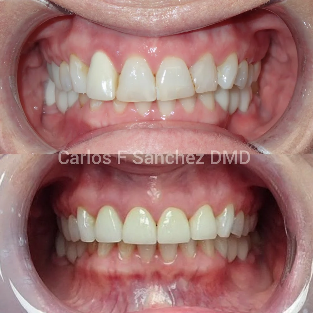 Penndel Dental -- Carlos F. Sanchez DMD Picture 10