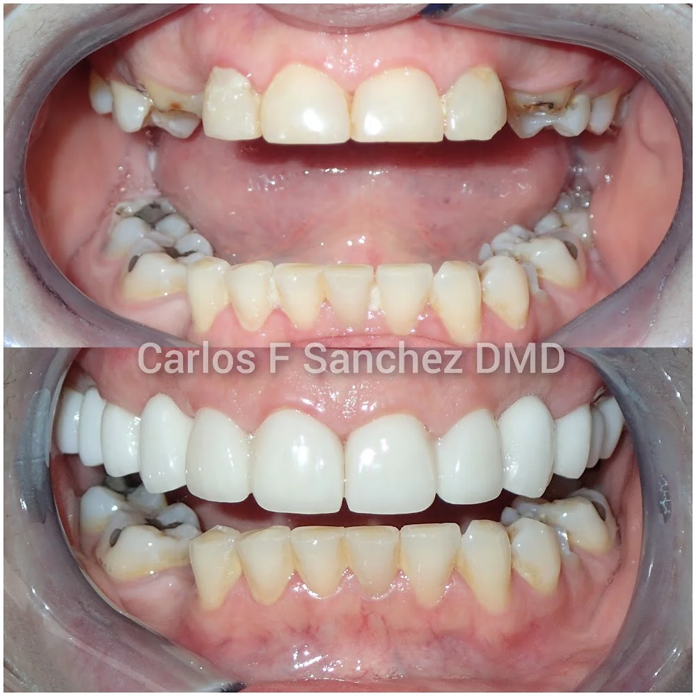 Penndel Dental -- Carlos F. Sanchez DMD Picture 8