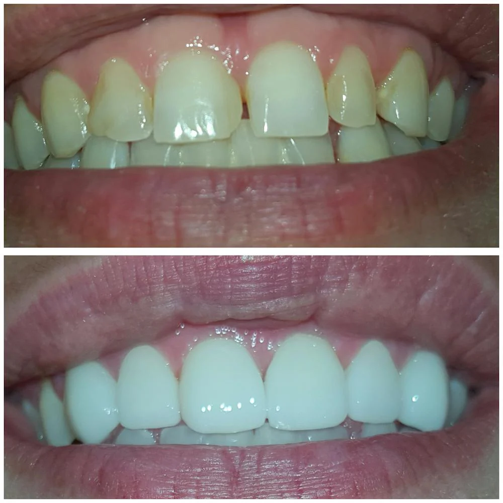 Ace Dental Center Picture 1