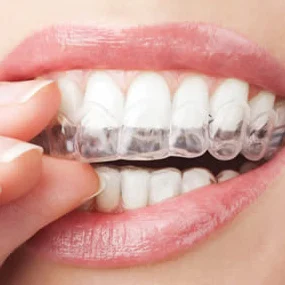 Braces West Chicago IL Picture 5